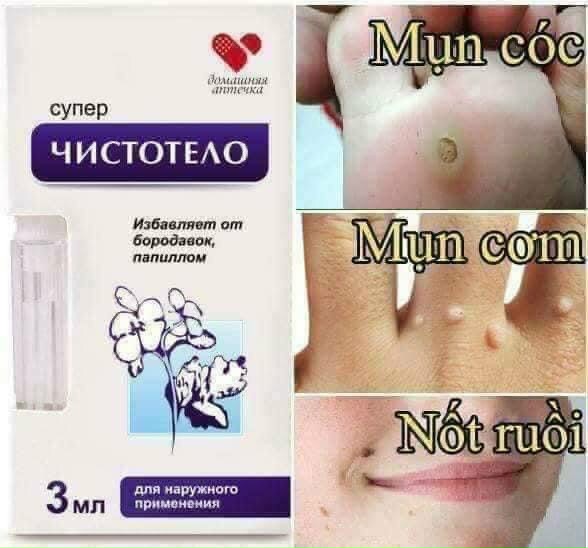 Gel tẩy nốt ruồi, sẹo lồi, mụn cơm, mục cóc Nga 3ml