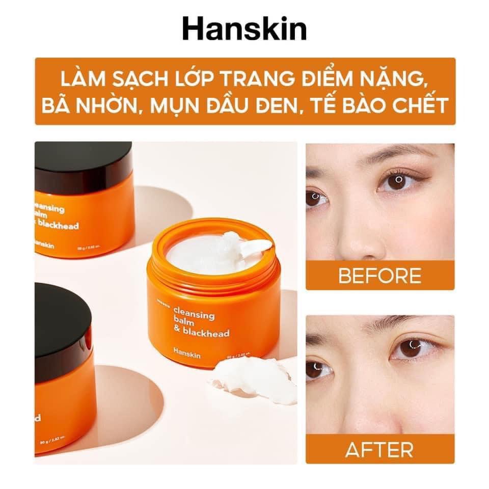Sáp Tẩy Trang Hanskin AHA Cleansing Balm & Blackhead hũ 80gr