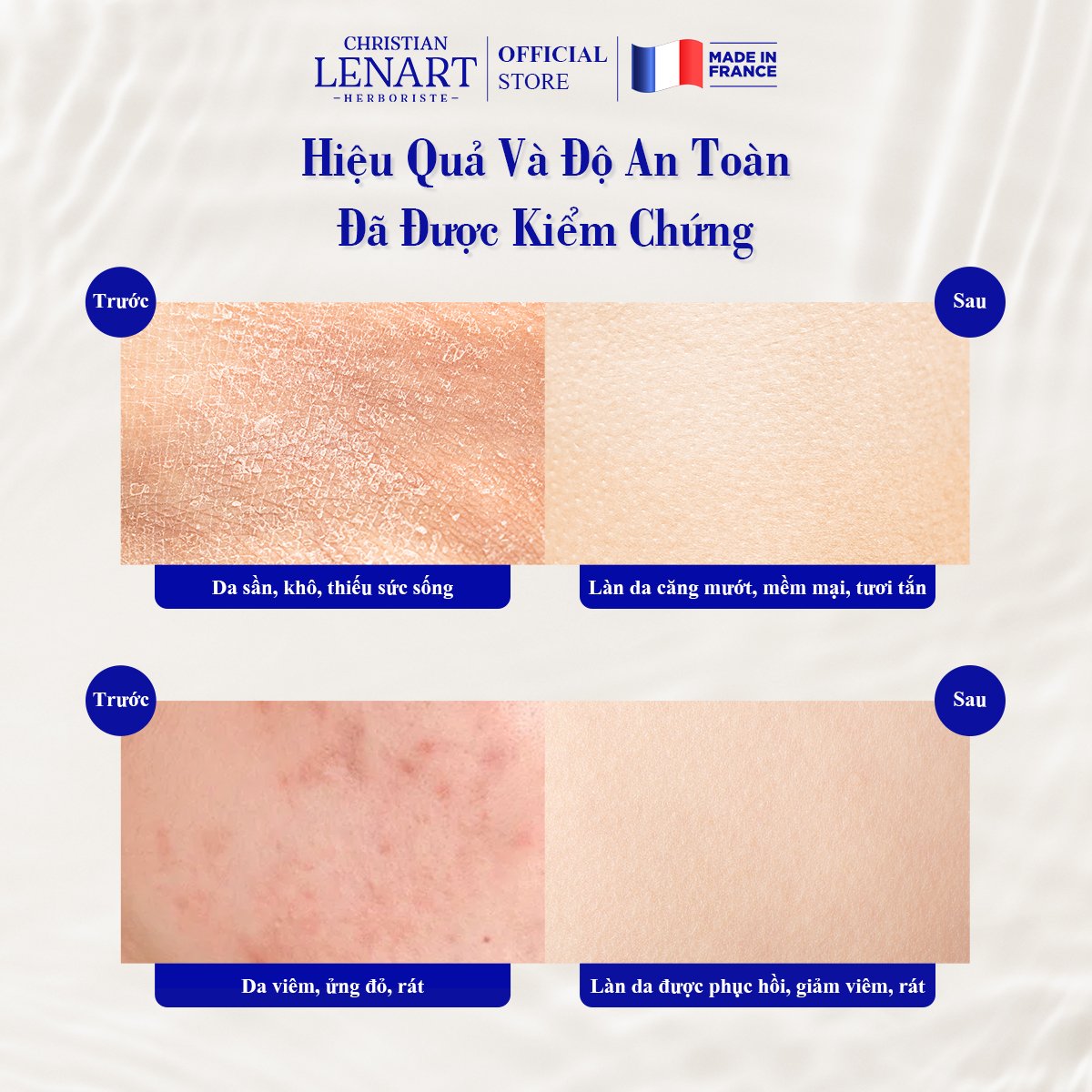 Nước hoa hồng Christian Lenart  hữu cơ Organic 100% Pháp 200ml