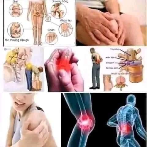 Thuốc trị đau nhức xương khớp Thái Lan NOXA 20 hộp 1 vỉ 10 viên