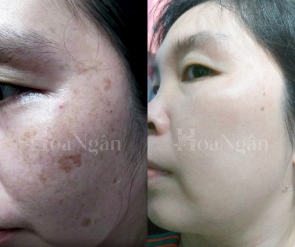 TINH CHẤT VI SINH 2.0