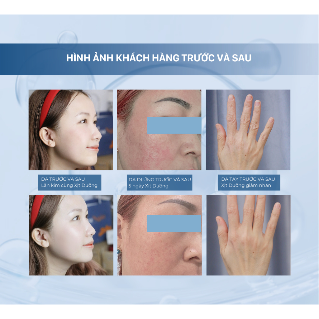 XỊT DƯỠNG CHUYÊN SÂU MIRACLE ESSENCE
