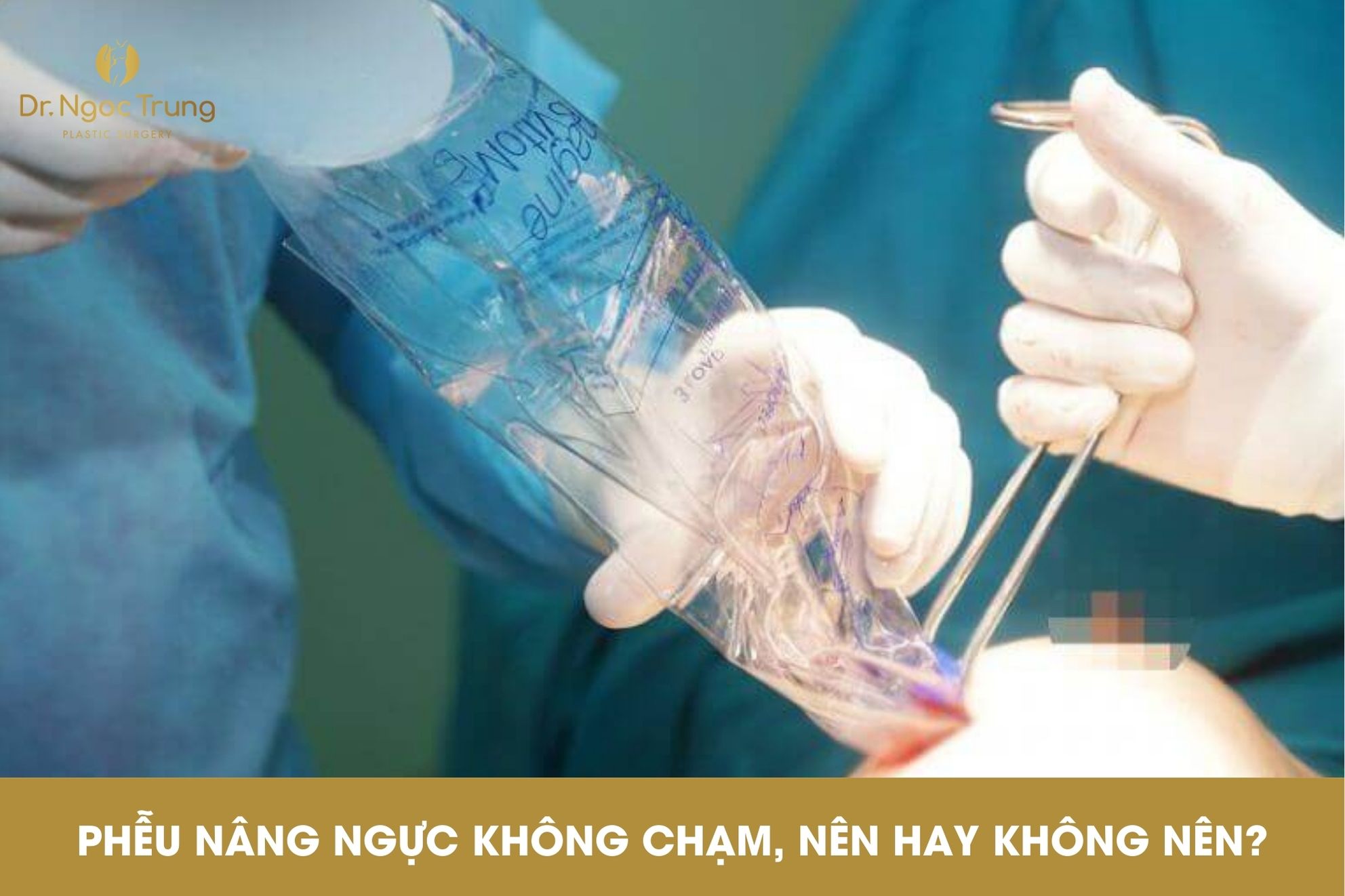 Đặt phễu không chạm khi nâng ngực, nên hay không nên?