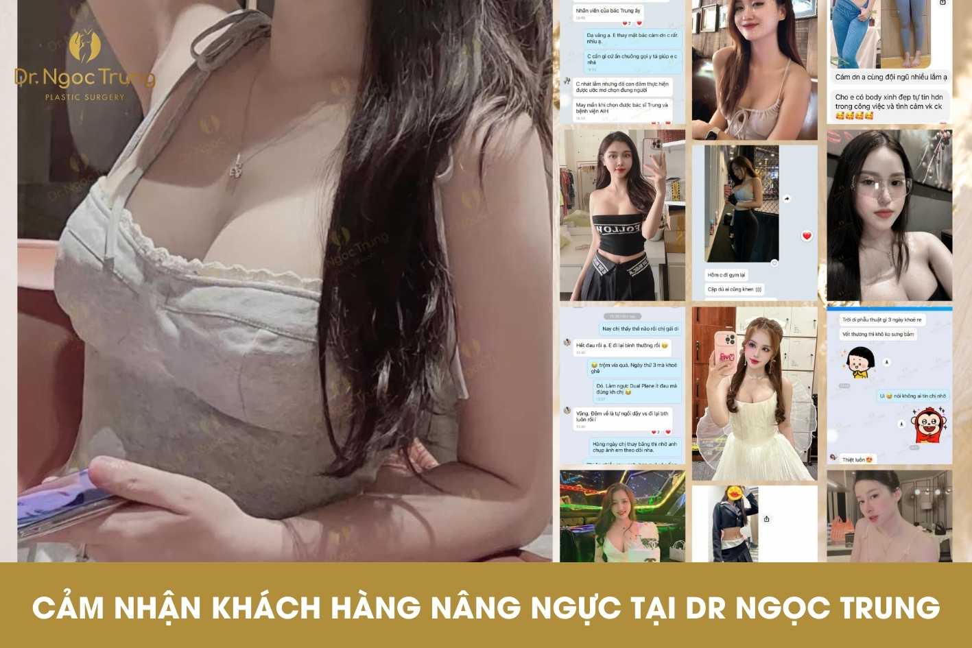 [TỔNG HỢP] - Cảm nhận khách hàng khi nâng ngực tại Dr Ngọc Trung