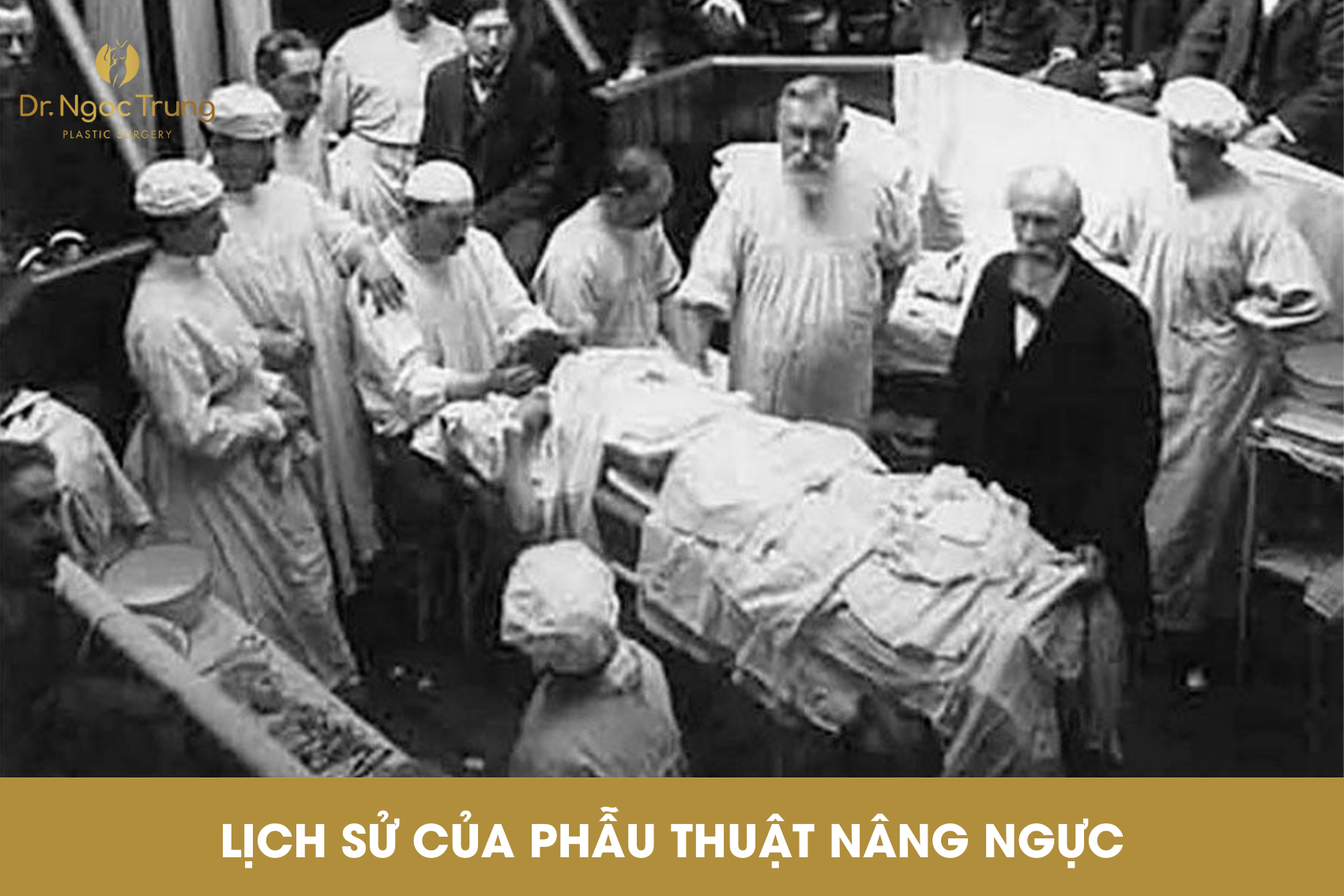 [Kiến thức thẩm mỹ] - Lịch sử của phẫu thuật nâng ngực