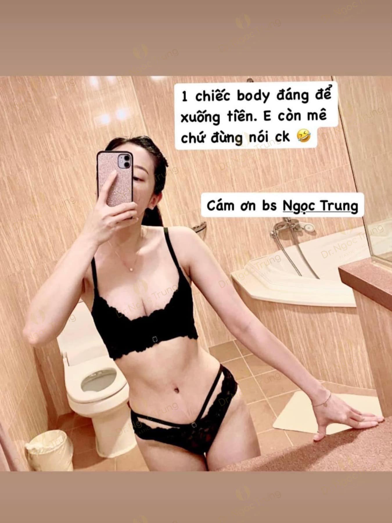 Hút mỡ, tạo hình thành bụng