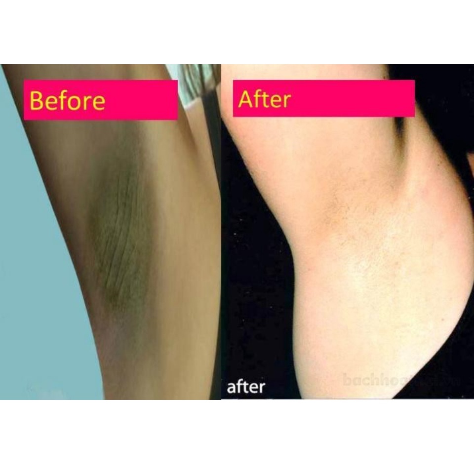CHE TÊN SP Kem giảm thâm Nách và khử mùi hôi nách 88 Total White Underarm Cream Thái Lan 35gr