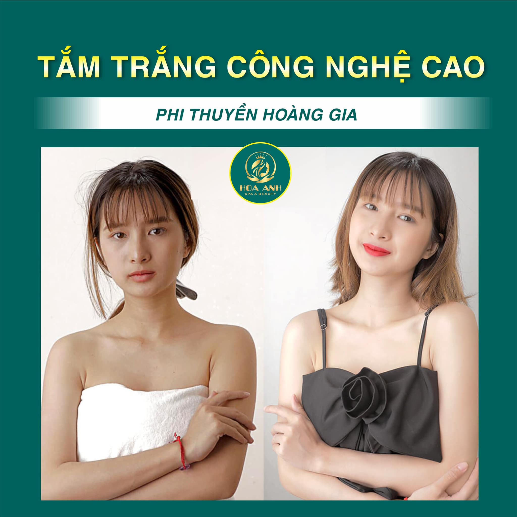 TẮM TRẮNG PHI THUYỀN CÓ TRẮNG THỰC SỰ - HIỆU QUẢ SAU KHI TẮM TRẮNG PHI THUYỀN HOÀNG GIA