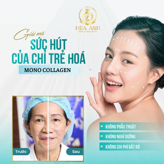 CĂNG CHỈ COLLAGEN LÀ GÌ ? CĂNG CHỈ COLLAGEN GIÚP CĂNG BÓNG DA