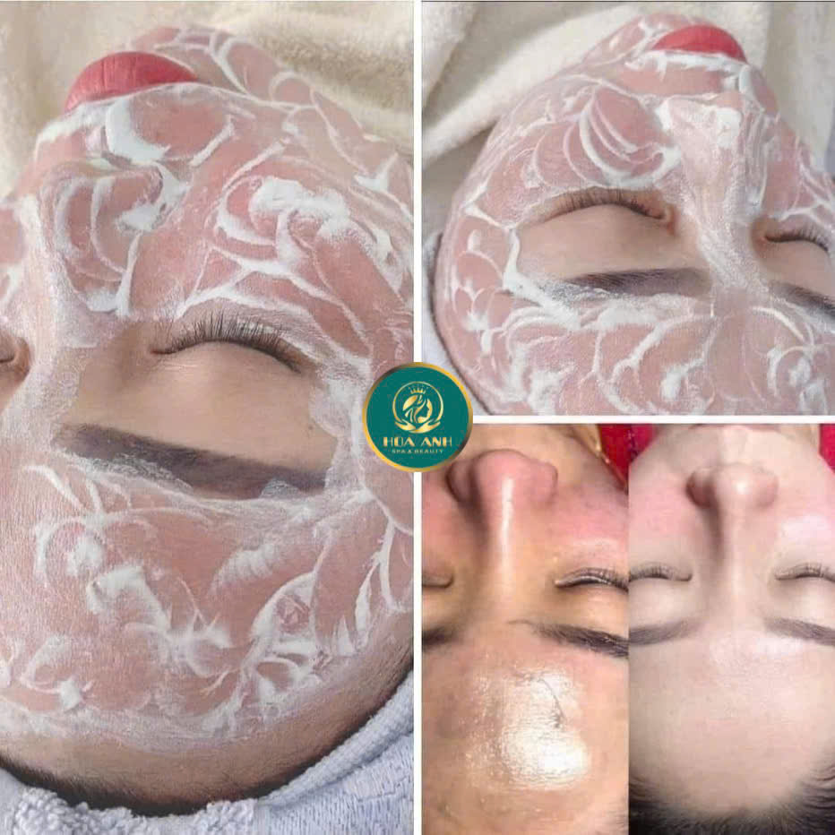 Khóa Học Cấy Trắng Da Mặt – Xu Hướng Nghề Nghiệp Đầy Tiềm Năng Trong Ngành Làm Đẹp