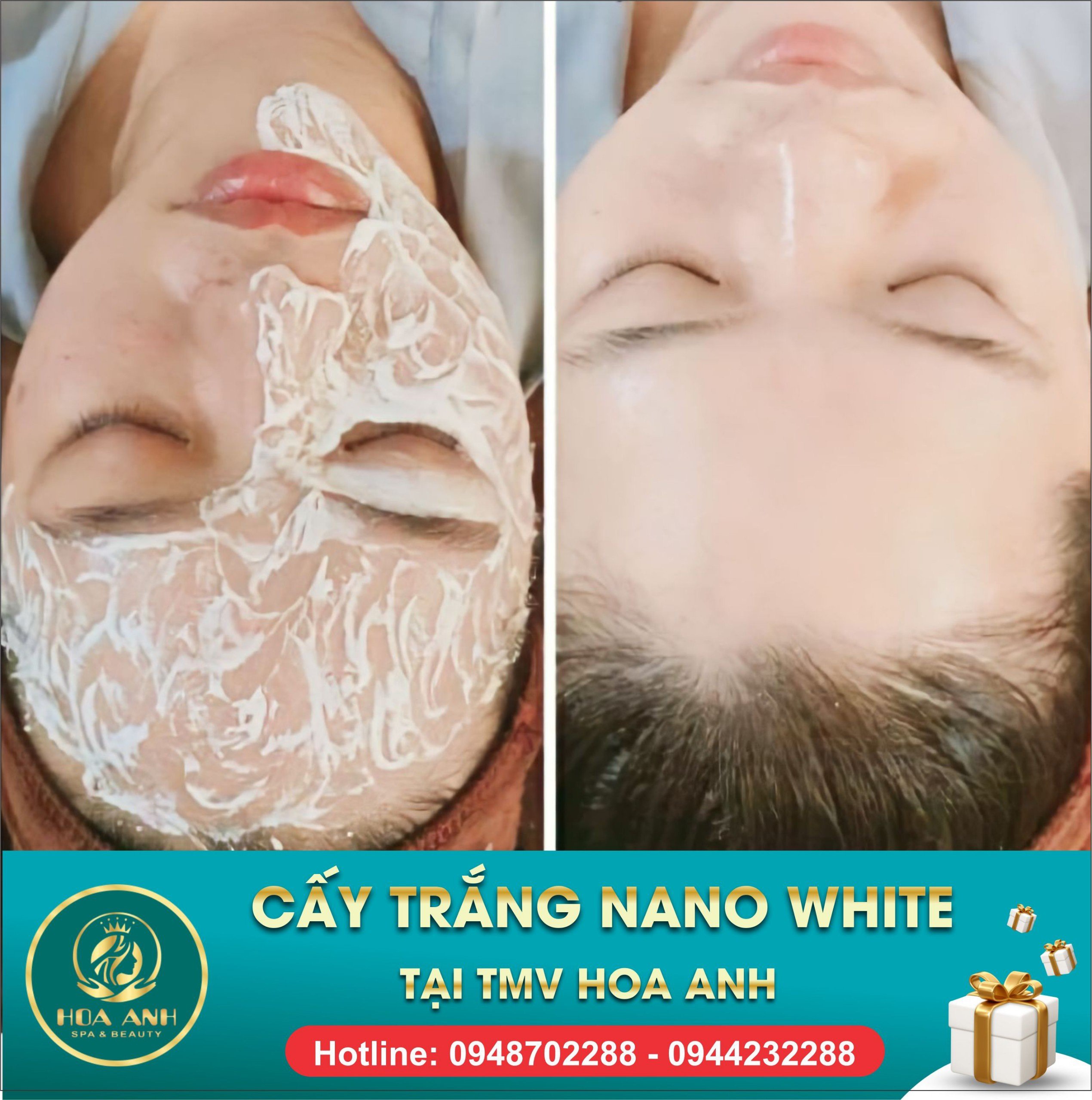 Khóa Học Cấy Trắng Chuyên Nghiệp - Bí Quyết Làn Da Hoàn Hảo