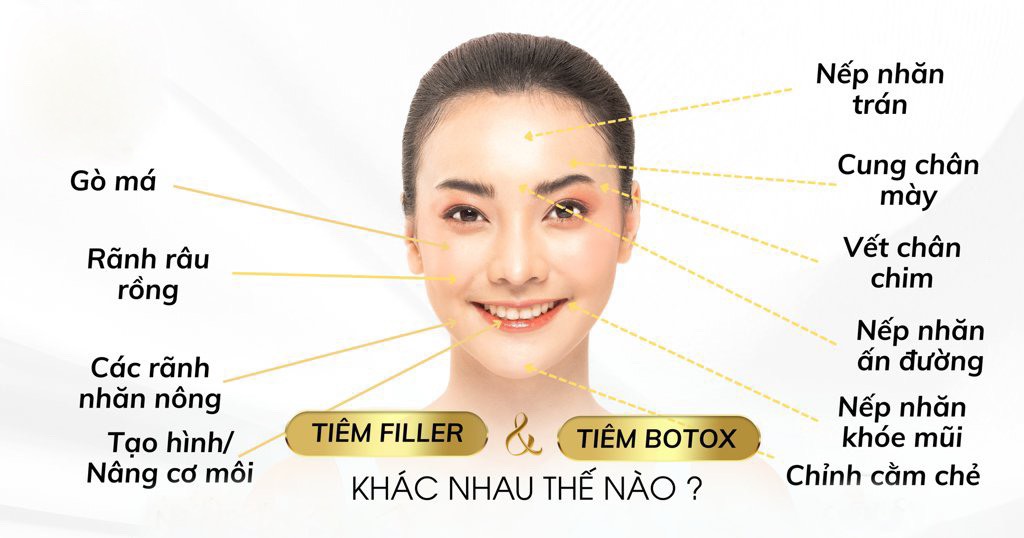 SỰ KHÁC BIỆT GIỮA TIÊM FILLER VÀ TIÊM BOTOX - NHỮNG AI CẦN TIÊM FILLER VÀ BOTOX