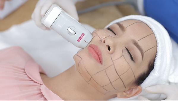 NÂNG CƠ HIFU LÀ GÌ ? NÂNG CƠ HIFU CÓ TÁC DỤNG GÌ CHO DA MẶT