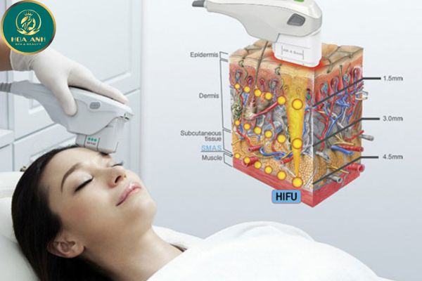 Khóa học Nâng cơ Hifu & Thermage – Giải pháp trẻ hóa da không xâm lấn