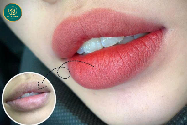 Khóa học Khử Thâm Môi – Cơ hội vàng cho nghề làm đẹp
