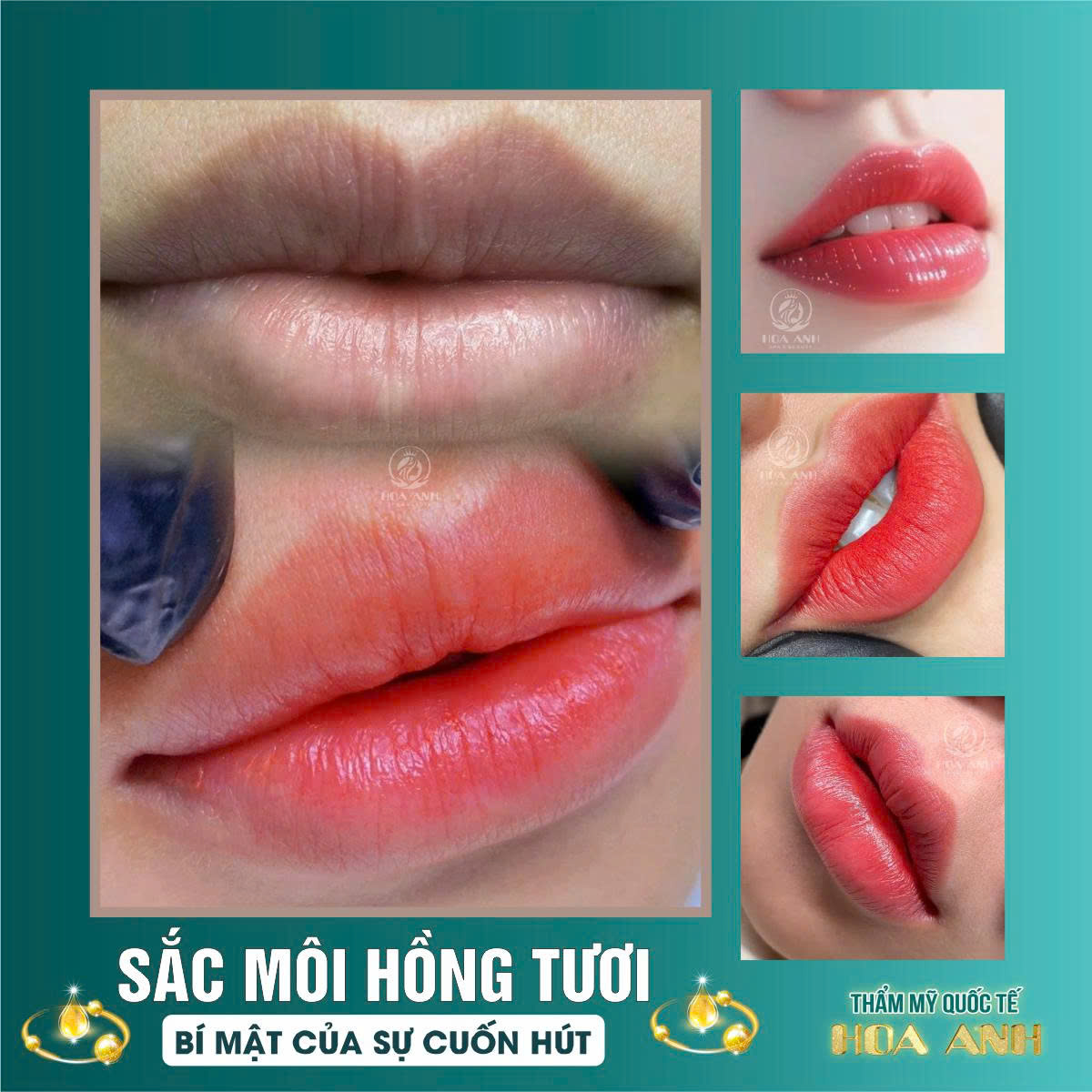Khóa Học Trẻ Hóa Da Môi: Cập Nhật Xu Hướng – Tăng Thu Nhập – Làm Nghề Lâu Dài
