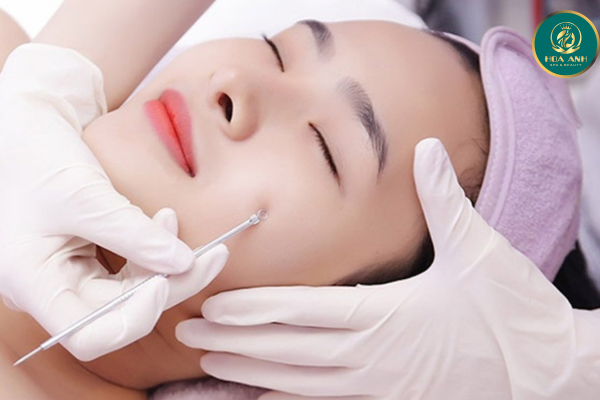 Khóa Học Lấy Mụn Chuyên Sâu – Bí Quyết Trở Thành Chuyên Gia Chăm Sóc Da Hàng Đầu