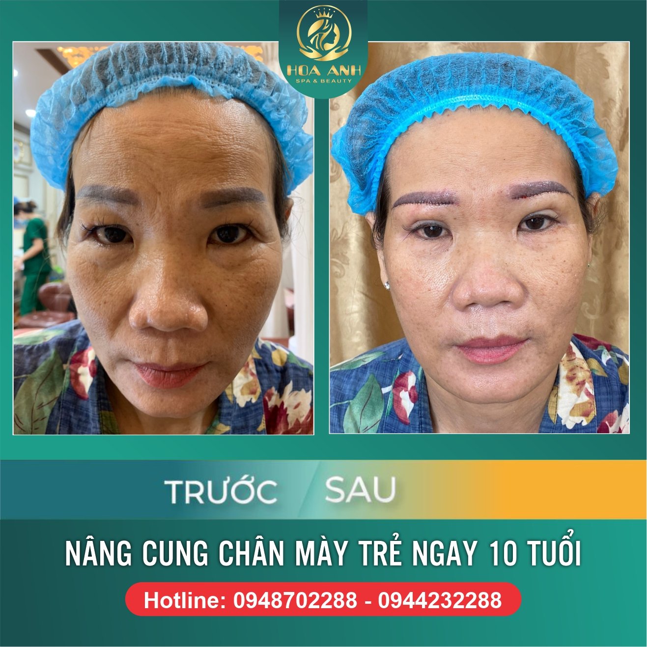 NÂNG CUNG CHÂN MÀY LÀ GÌ ? NHỮNG ĐIỀU CẦN BIẾT TRƯỚC KHI NÂNG CUNG CHÂN MÀY