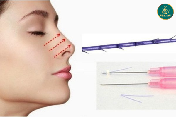 Khóa Học Nâng Mũi Bằng Chỉ - Bí Quyết Tạo Dáng Mũi Hoàn Hảo