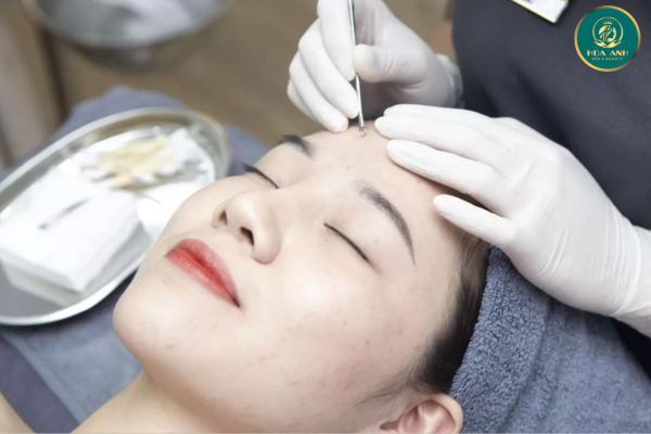 Khóa Học Chuyên Nghiệp: Kỹ Thuật Nặn Mụn An Toàn và Hiệu Quả