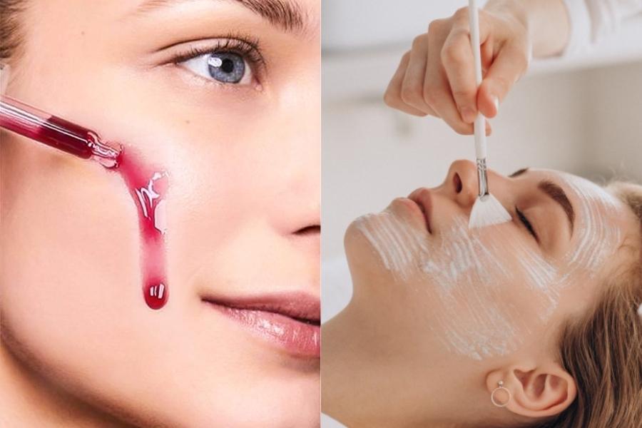 PHƯƠNG PHÁP PEEL DA TRỊ NÁM CÓ TỐT KHÔNG ? PEEL DA CÓ HẾT NÁM KHÔNG ?