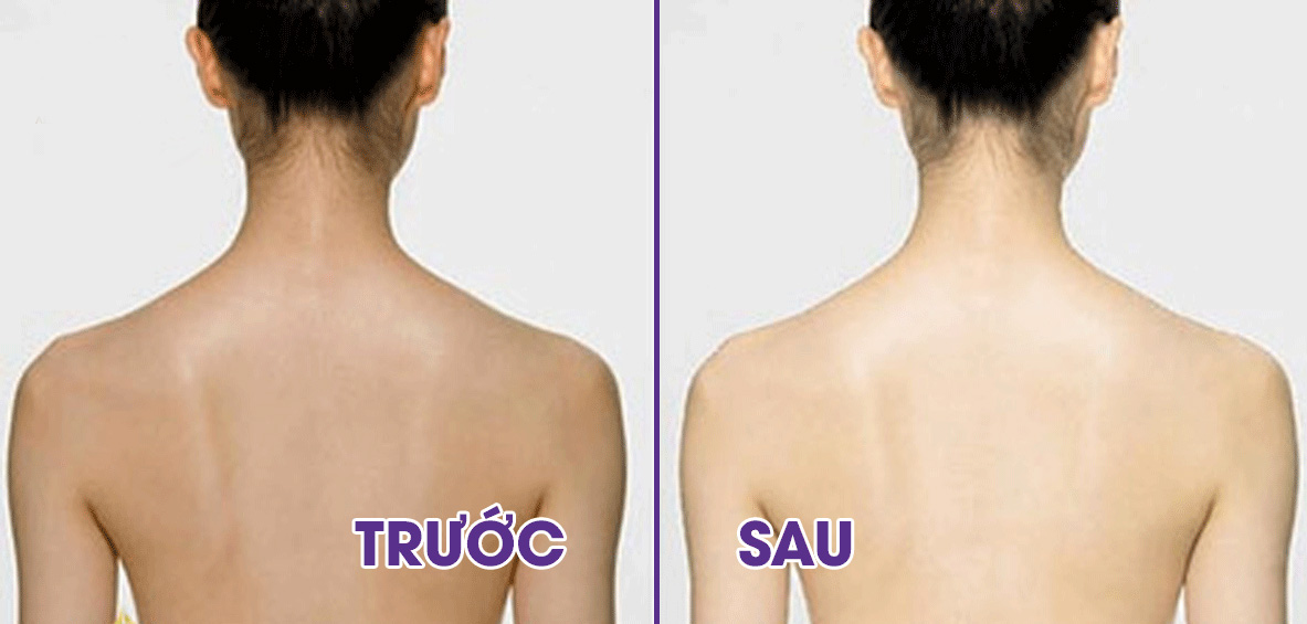 TẮM TRẮNG PHI THUYỀN LÀ GÌ ? TẮM TRẮNG PHI THUYỀN BAO LÂU THÌ BẬT TÔNG