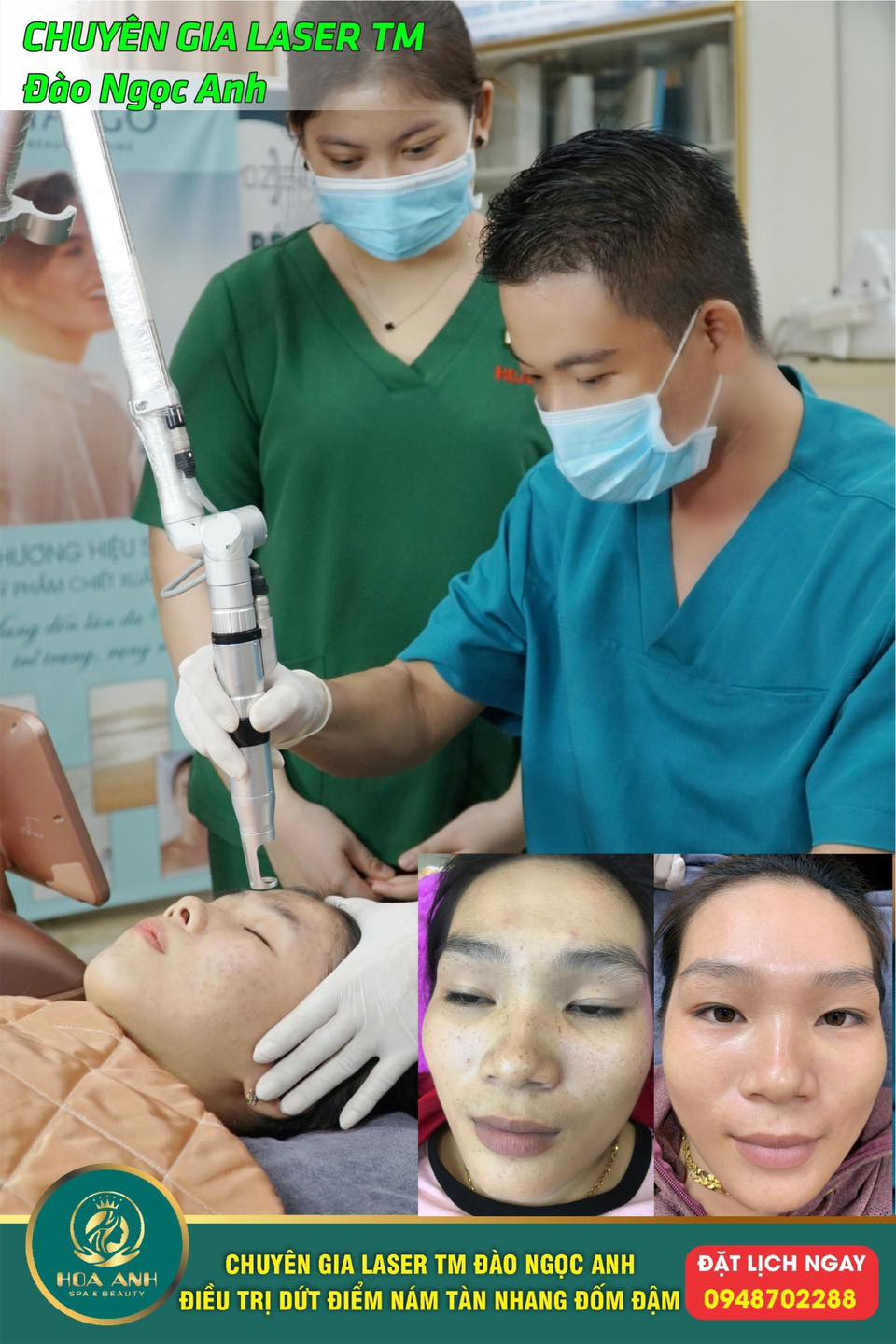 LASER TÀN NHANG CÓ HIỆU QUẢ KHÔNG ? CHĂM SÓC DA SAU KHI XÓA TÀN NHANG