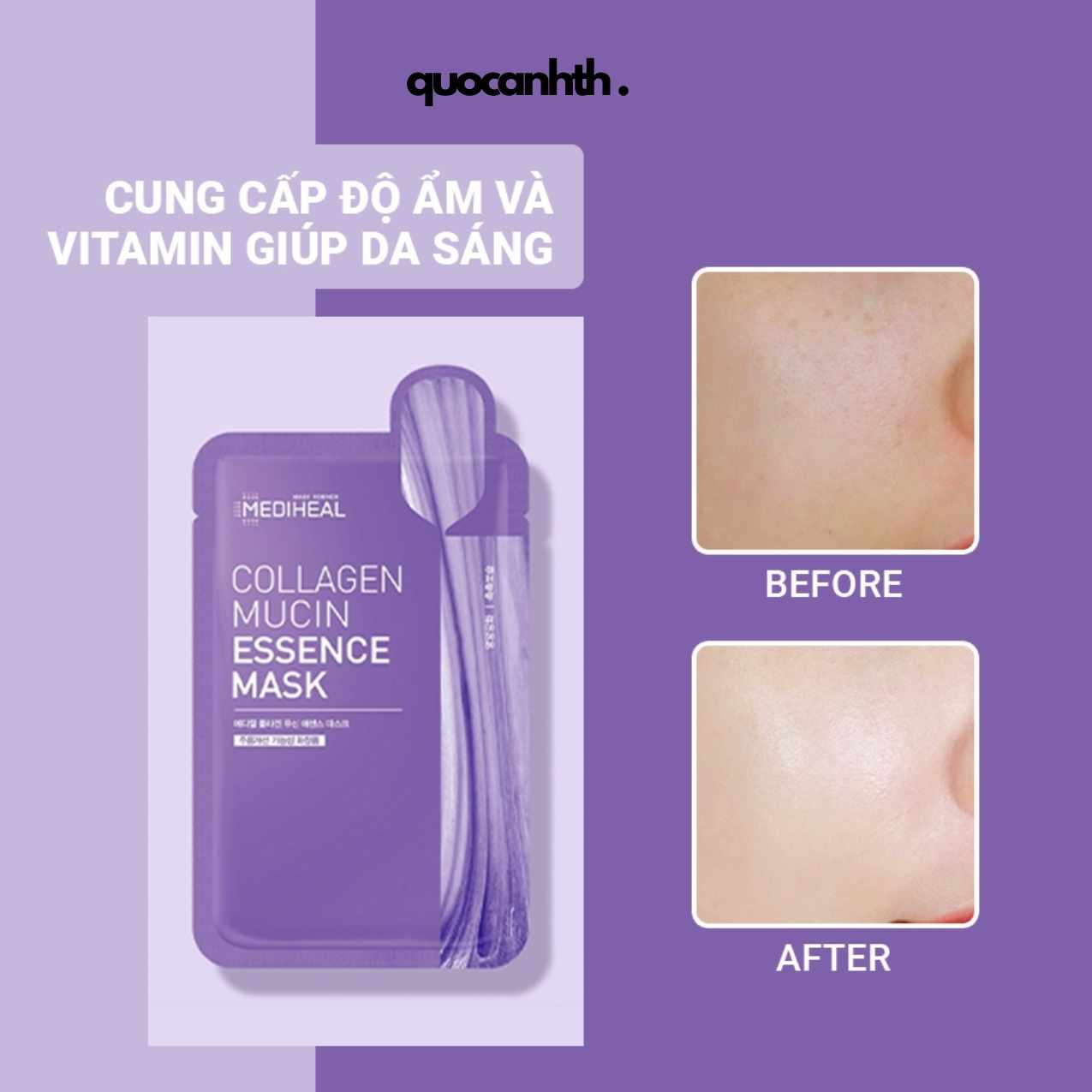 Mặt Nạ Mediheal Essence Mask