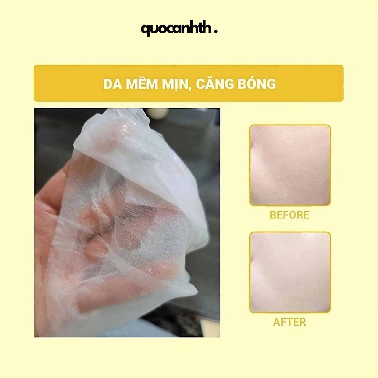 Mặt Nạ Mediheal Essence Mask
