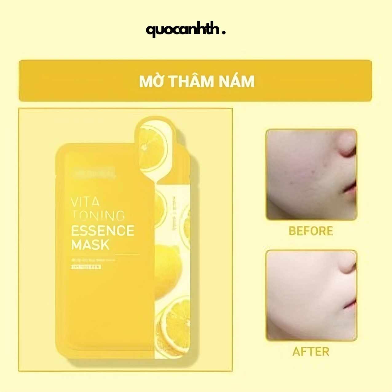 Mặt Nạ Mediheal Essence Mask