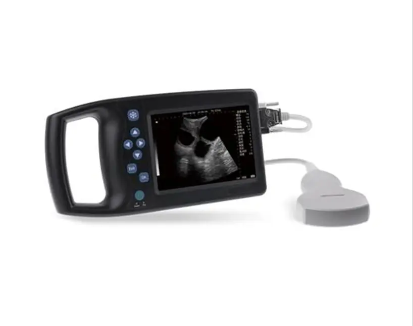 Máy siêu âm kĩ thuật số A6
