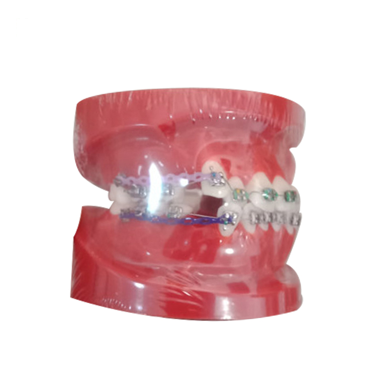 Mô hình chỉnh nha sai khớp cắn