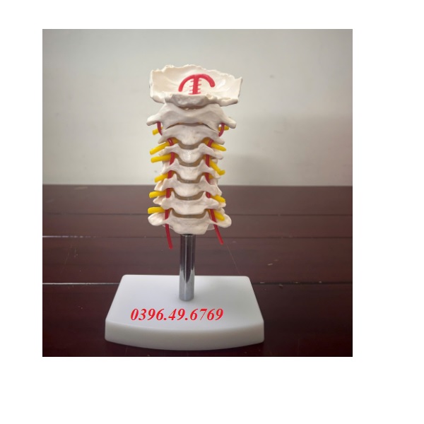 MÔ HÌNH CỘT SỐNG CỔ CÓ ĐỘNG MẠCH CỔ