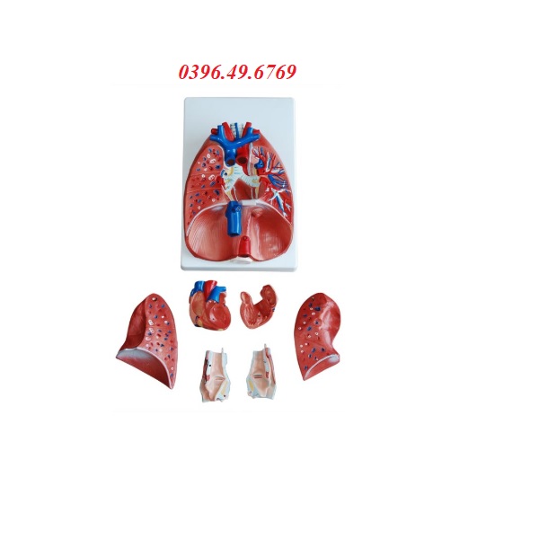 Mô hình giải phẫu phổi 7 mảnh