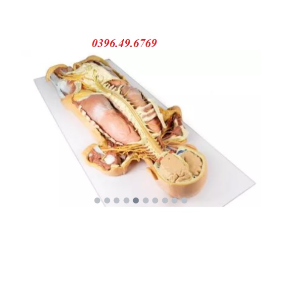 MÔ HÌNH GIẢI PHẪU 3D HỆ THẦN KINH BÓC TÁCH NHÌN TỪ PHÍA SAU MP1400 ZIMMER