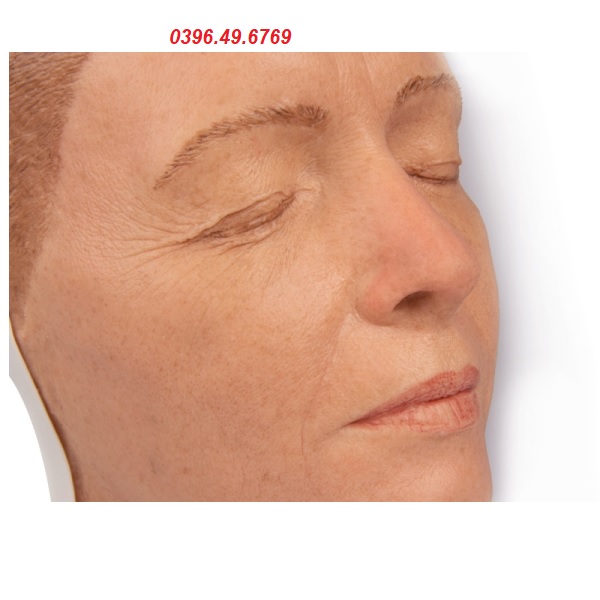 MÔ HÌNH TIÊM BOTOX THẨM MỸ CĂNG DA MẶT 8100 ERLER- ZIMMER