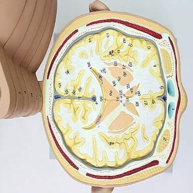 Mô hình cắt lớp vùng đầu mặt cổ