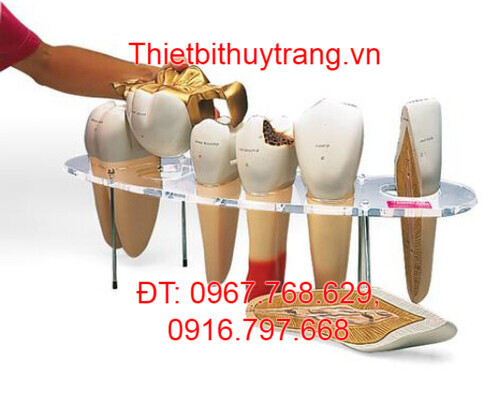 MÔ HÌNH CẤU TRÚC RĂNG 3B W42517