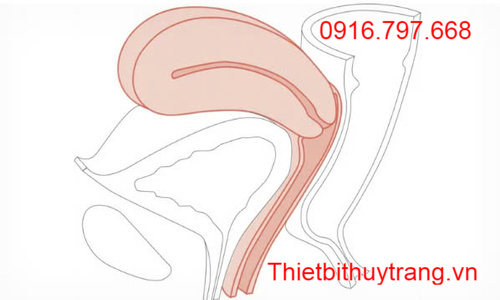 Mô Hình Cổ Tử Cung Bình Thường Chưa Sinh Limbs & Things 60920