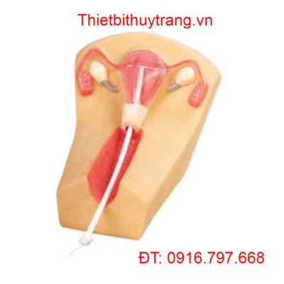 MÔ HÌNH ĐÀO TẠO ĐẶT VÒNG TRÁNH THAI GD/F5N