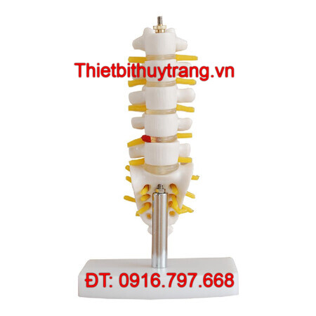 MÔ HÌNH ĐỐT SỐNG THẮT LƯNG VỚI XƯƠNG CÙNG XƯƠNG CỤT VÀ THOÁT VỊ ĐĨA ĐỆM TT-119A