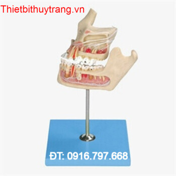 MÔ HÌNH GIẢI PHẪU BỆNH LÝ RĂNG CÓ HÀM GD/B10016