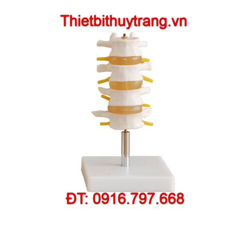 MÔ HÌNH GIẢI PHẪU ĐỐT XƯƠNG SỐNG THẮT LƯNG 4 CHIẾC TT-118