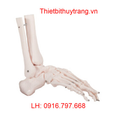 MÔ HÌNH GIẢI PHẪU KHỚP XƯƠNG BÀN CHÂN GD-A11201-6