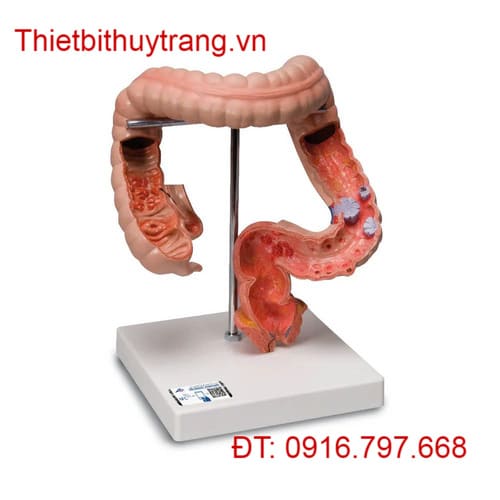 MÔ HÌNH GIẢI PHẪU RUỘT GIÀ 3B SCIENTIFIC 1008496