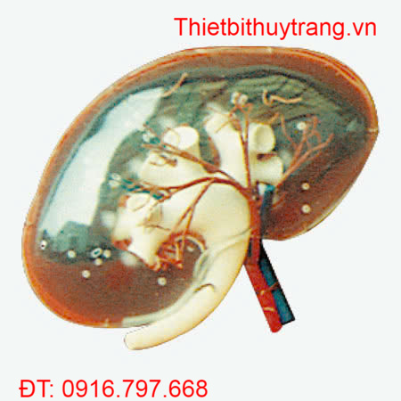 MÔ HÌNH GIẢI PHẪU THẬN TRONG SUỐT GD/A14008