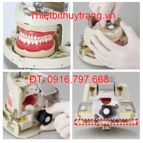 Mô Hình Hàm Và Khớp Cắn Nha Khoa Nissim Type 2