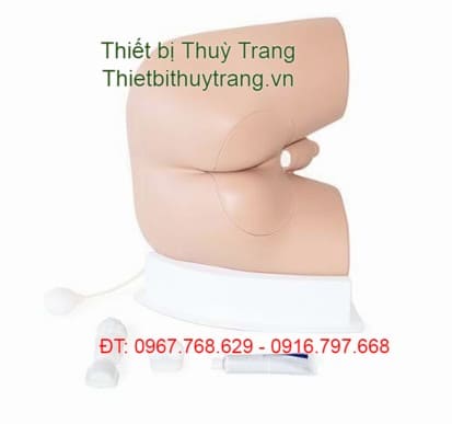 MÔ HÌNH THĂM KHÁM HẬU MÔN TRỰC TRÀNG CHẤT LƯỢNG CAO