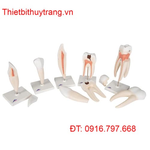 BỘ MÔ HÌNH RĂNG NGƯỜI CLASSIC SERIES 5 MÔ HÌNH 3B SCIENTIFIC 1017588