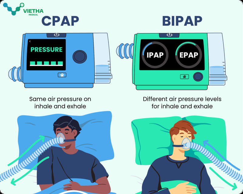 Sự khác nhau giữ máy trợ thở CPAP và BIPAP ?